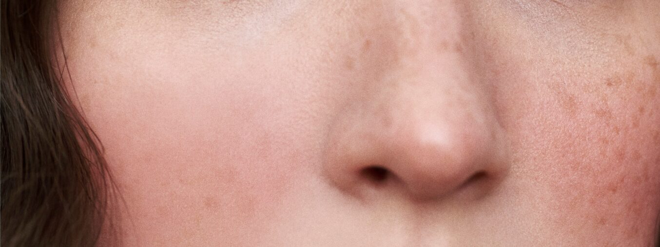 The Best Non-Comedogenic Makeup for a Flawless Look Without Breakouts