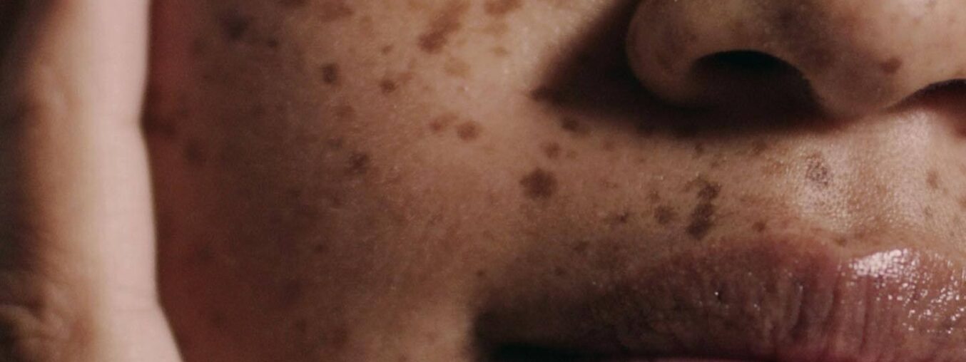 Dermatologists' Top Picks for Oily Skin Care