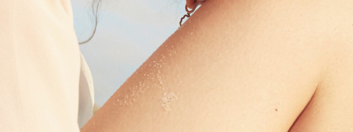 How to Treat and Prevent Body Acne Breakouts