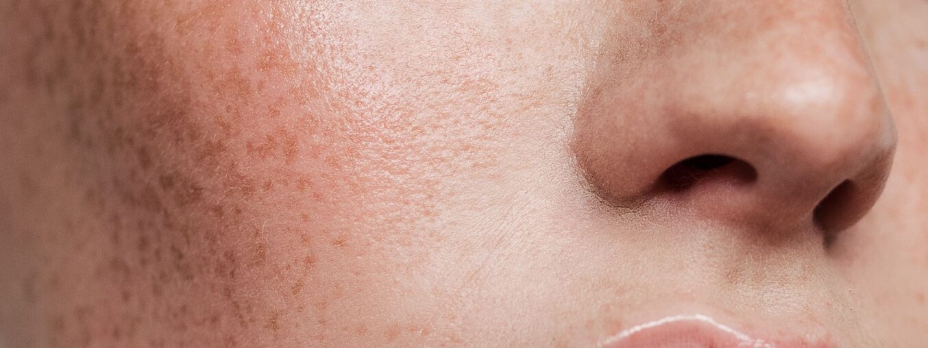 Augustinus Bader's new vitamin C brightens skin without causing irritation.