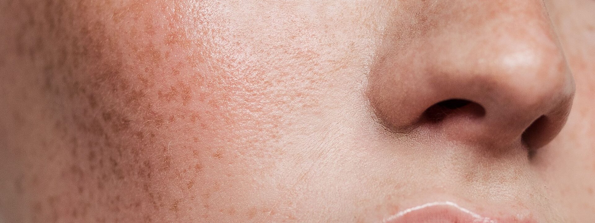 Augustinus Bader's new vitamin C brightens skin without causing irritation.