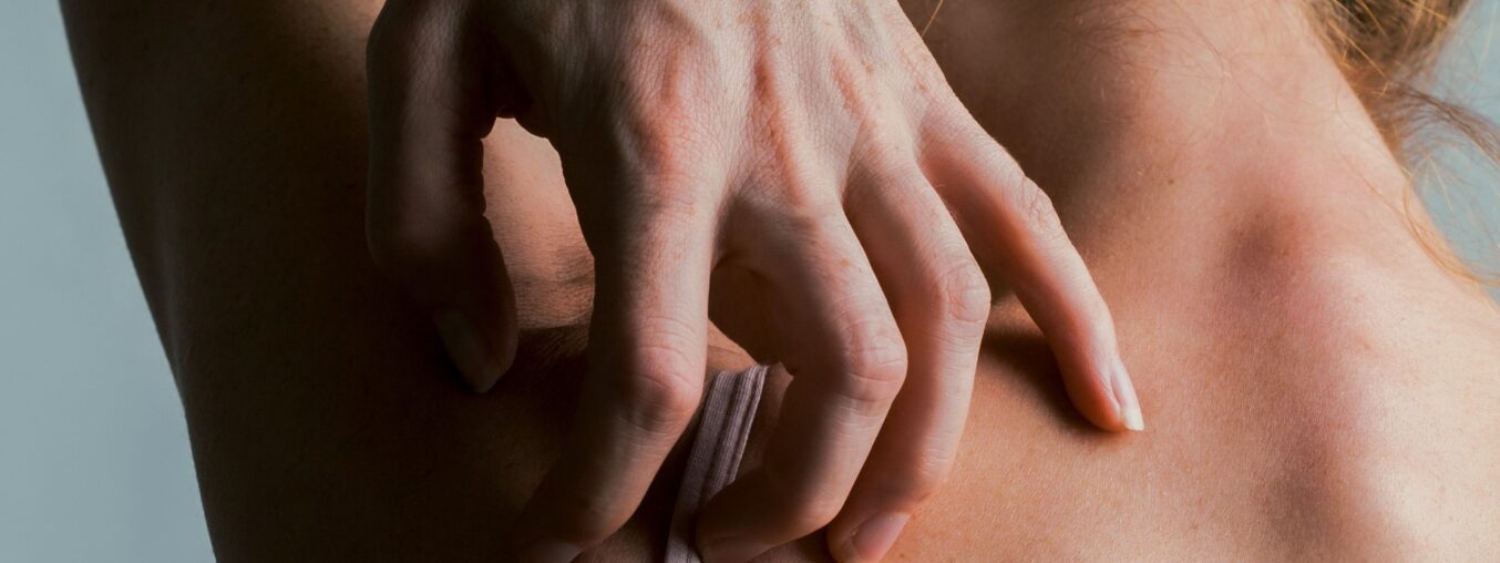 Everything You Need to Know About Skin Itching with Ozempic