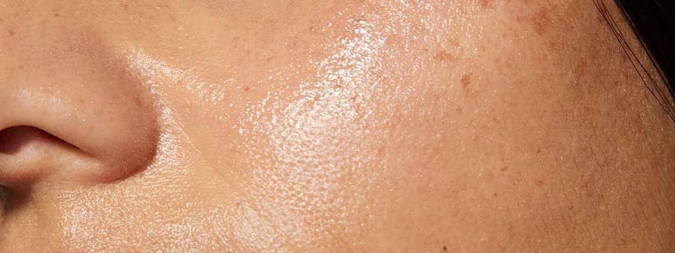 This traditional Chinese medicine trick clears up acne breakouts quickly.