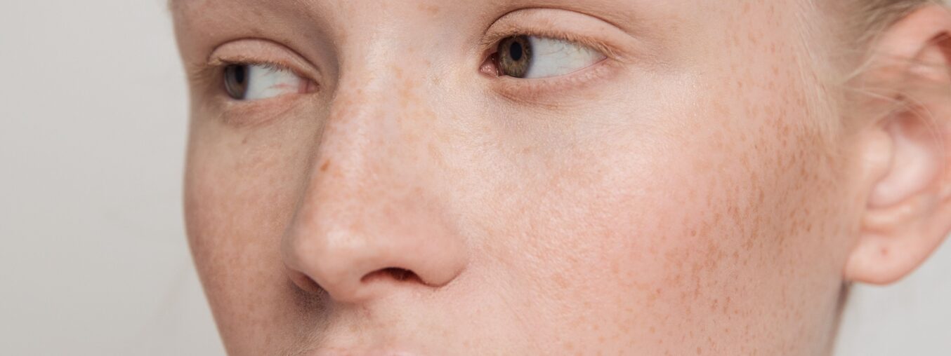 The best azelaic acid products fight breakouts, fade dark spots, and reduce redness all in one go.