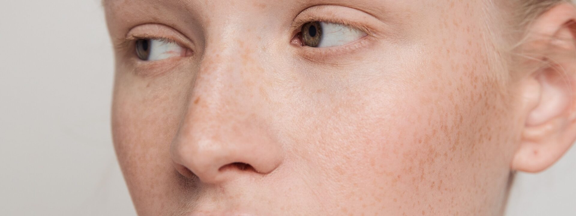 The best azelaic acid products fight breakouts, fade dark spots, and reduce redness all in one go.